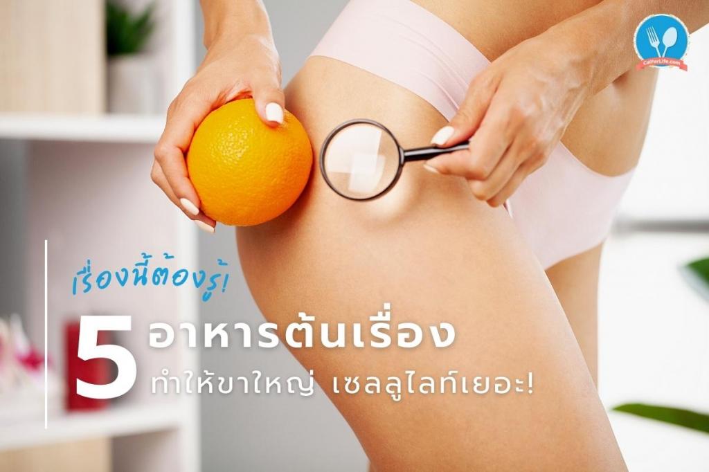 เรื่องนี้ต้องรู้! 5 อาหารต้นเรื่องทำให้ขาใหญ่ เซลลูไลท์เยอะ!